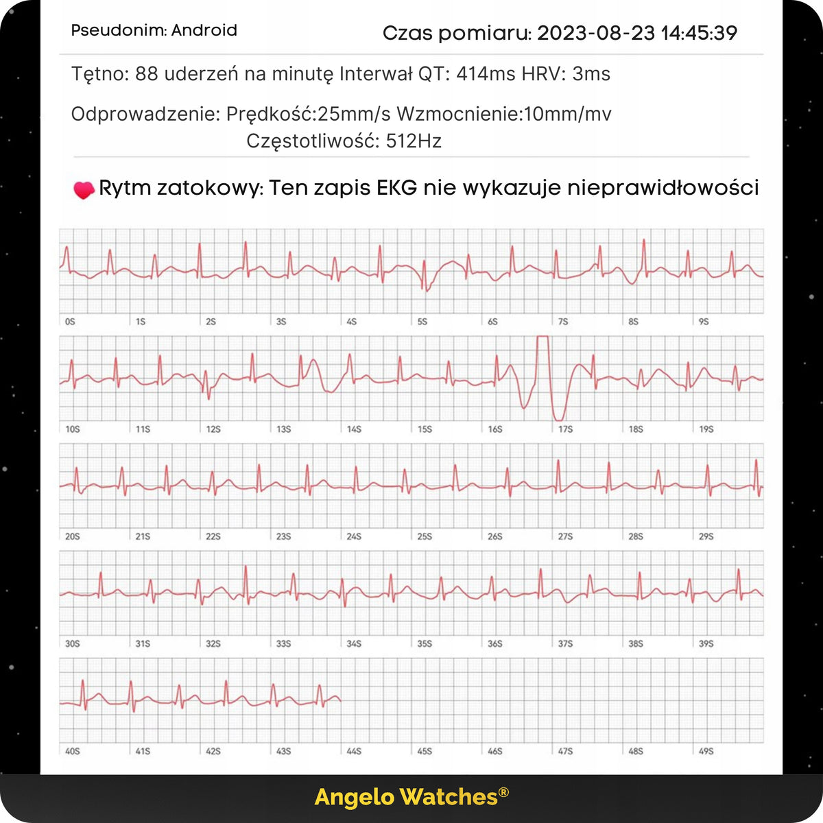 2X SMARTWATCH CARDIOWATCH MEN'S CALL WATCH EKG HRV PPG MENU PL + GRATI Model other