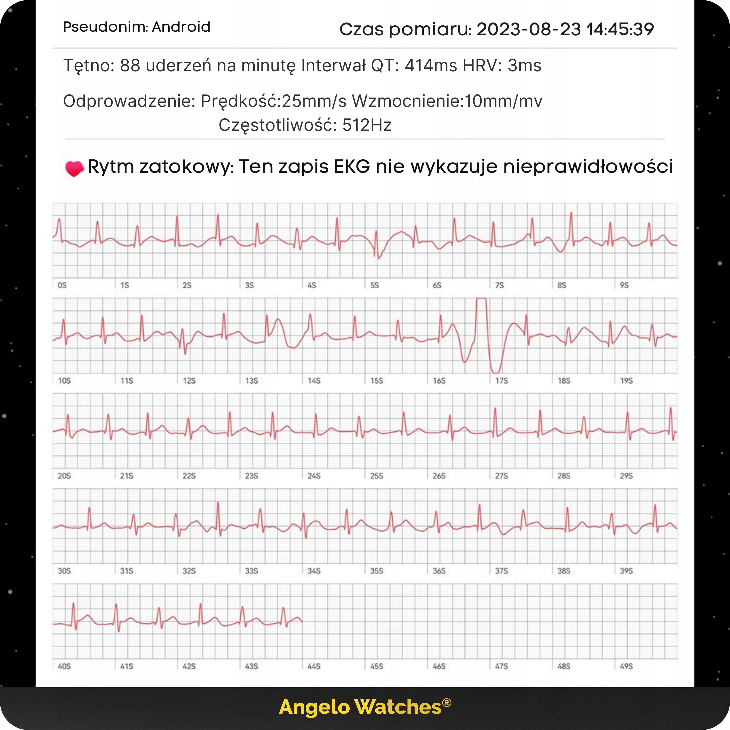2X SMARTWATCH MEN'S WATCH CARDIOWATCH BLOOD PRESSURE MONITOR EKG HRV MENU STRIPS P