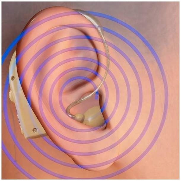 2x GERMAN HEARING AID SOUND AMPLIFIER BEHIND-THE-EAR LIGHT DISCREET Packaging status original