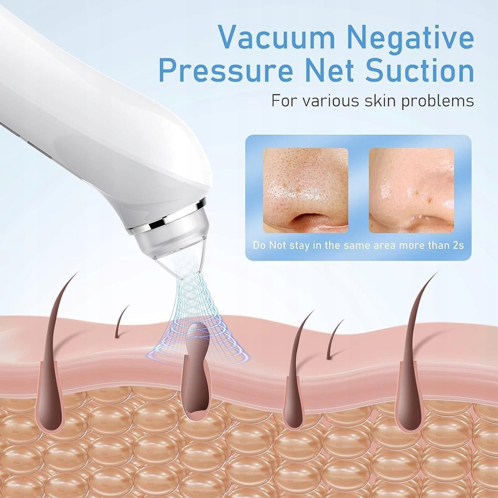 Blackhead Remover Vacuum Black Head Extractions Tool,with Camera USB Medical device type accessories for a medical device or a product without an intended medical purpose