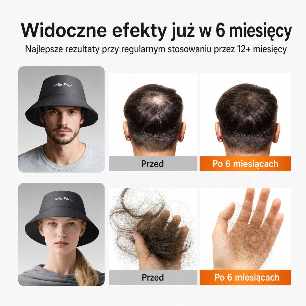 Cap LED Hat For Hair Growth BALDNESS 336 LEDs Brand no brand