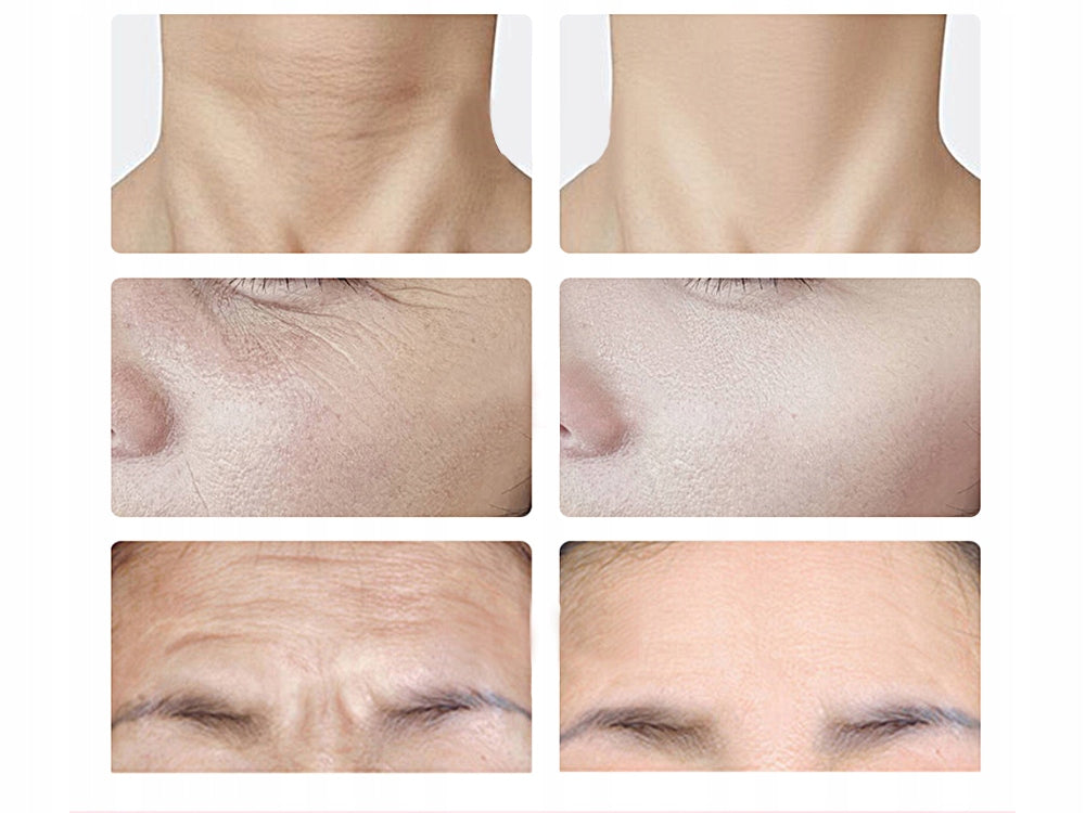 MASSAGER FOR FIRMING THE NECK AND FACE EMS LIFTING THE CHIN FIRMS EMS Manufacturer code 24427_B