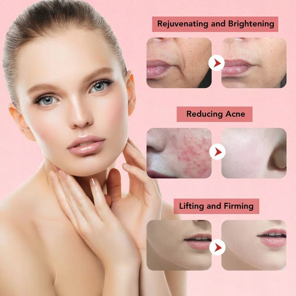 NEEDLELESS MESOTHERAPY FACE EMS MASSAGER LIFTING LYMPHATIC DRAINAGE v3.0 ! Manufacturer code v333