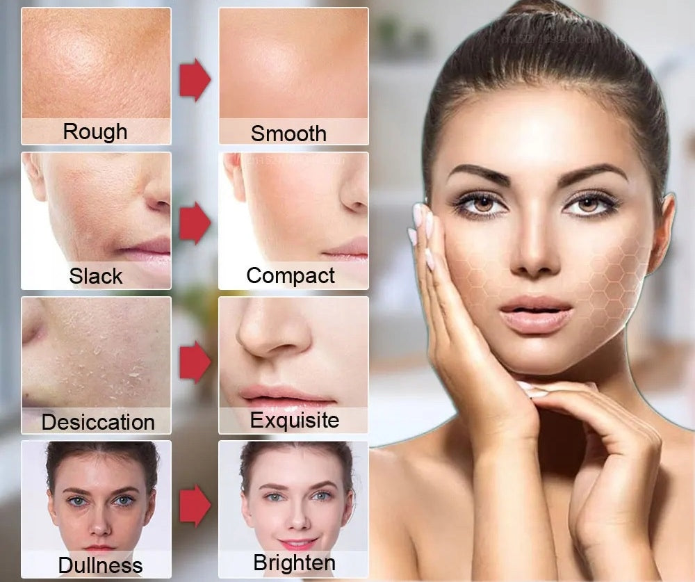 NEEDLELESS MESOTHERAPY FACE EMS MASSAGER LIFTING REJUVENATION 2x LED v3.0 Manufacturer code MEZOTERAPIA MASAŻER EMS TWARZY LIFTING 3.0