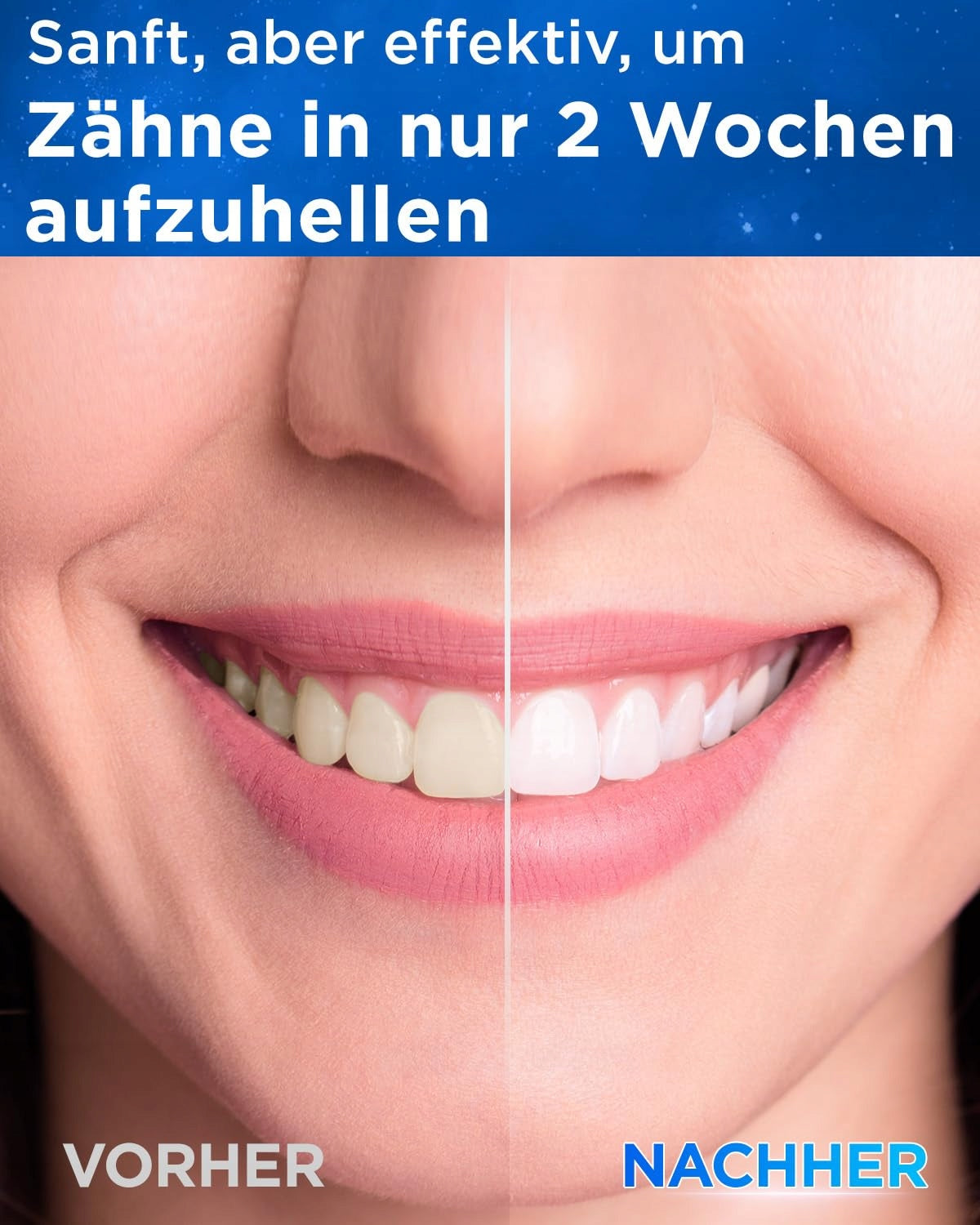 YTEATH Adult Sonic Toothbrush 120 Days 8 Heads 5 Modes Kind toothbrush