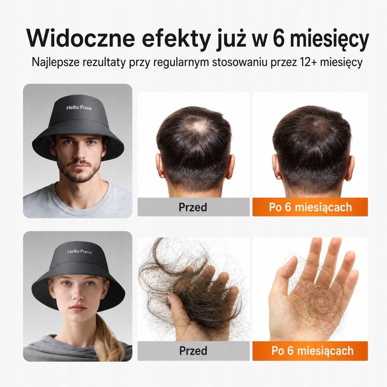 Cap LED Hat For Hair Growth BALDNESS 336 LEDs Brand no brand