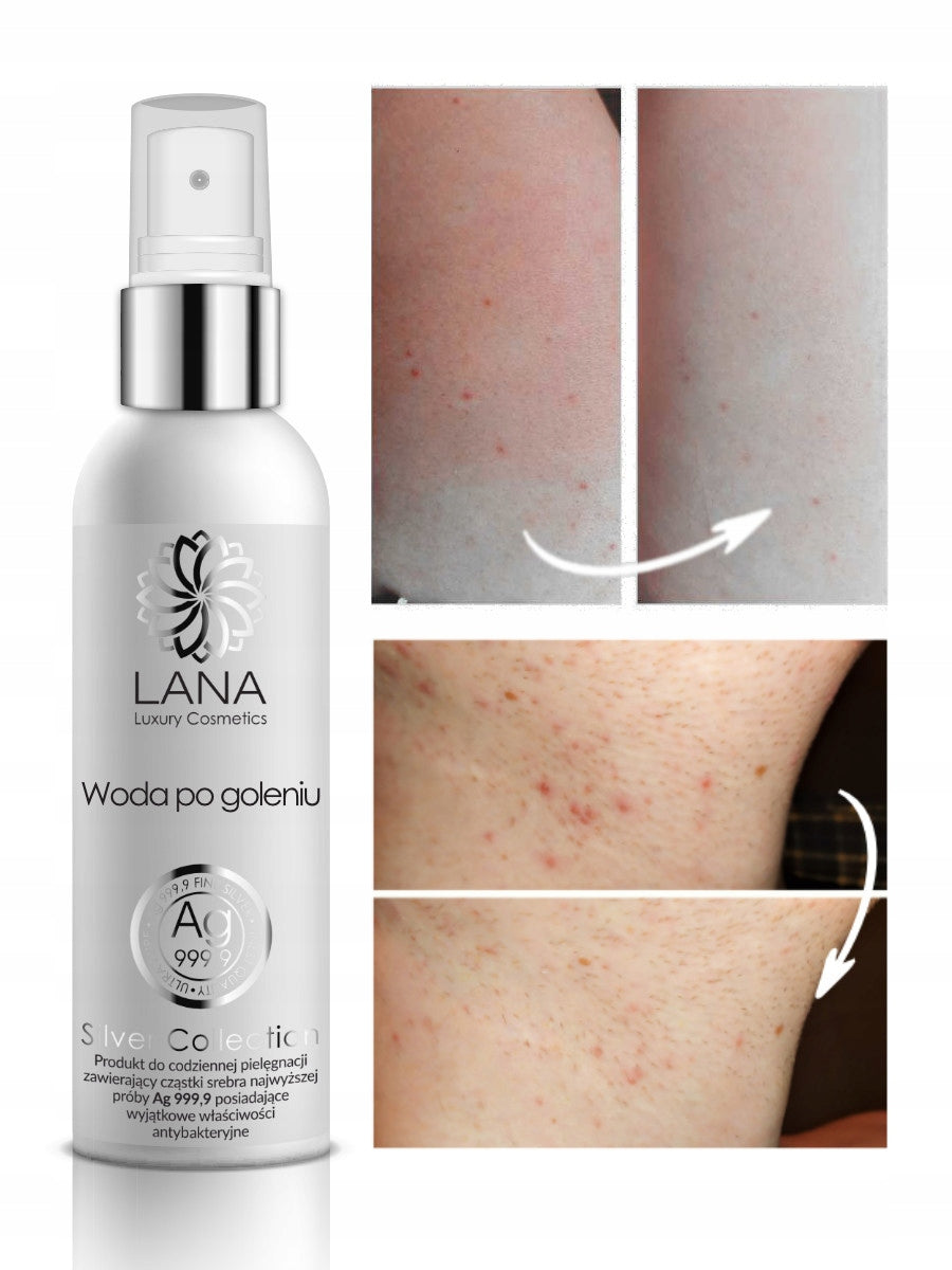 DERMKOSMETYK Aftershave for IRRITATION 100ml Brand Lana