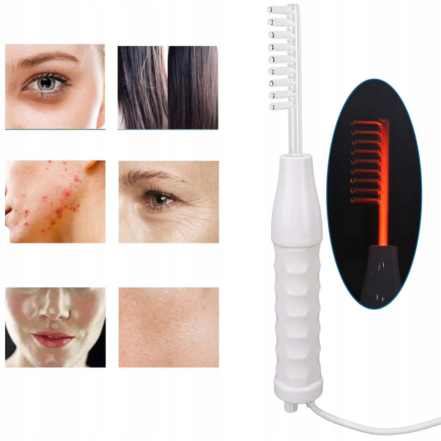 High Frequency Therapy Device Portable Acne Treatment Medical device no