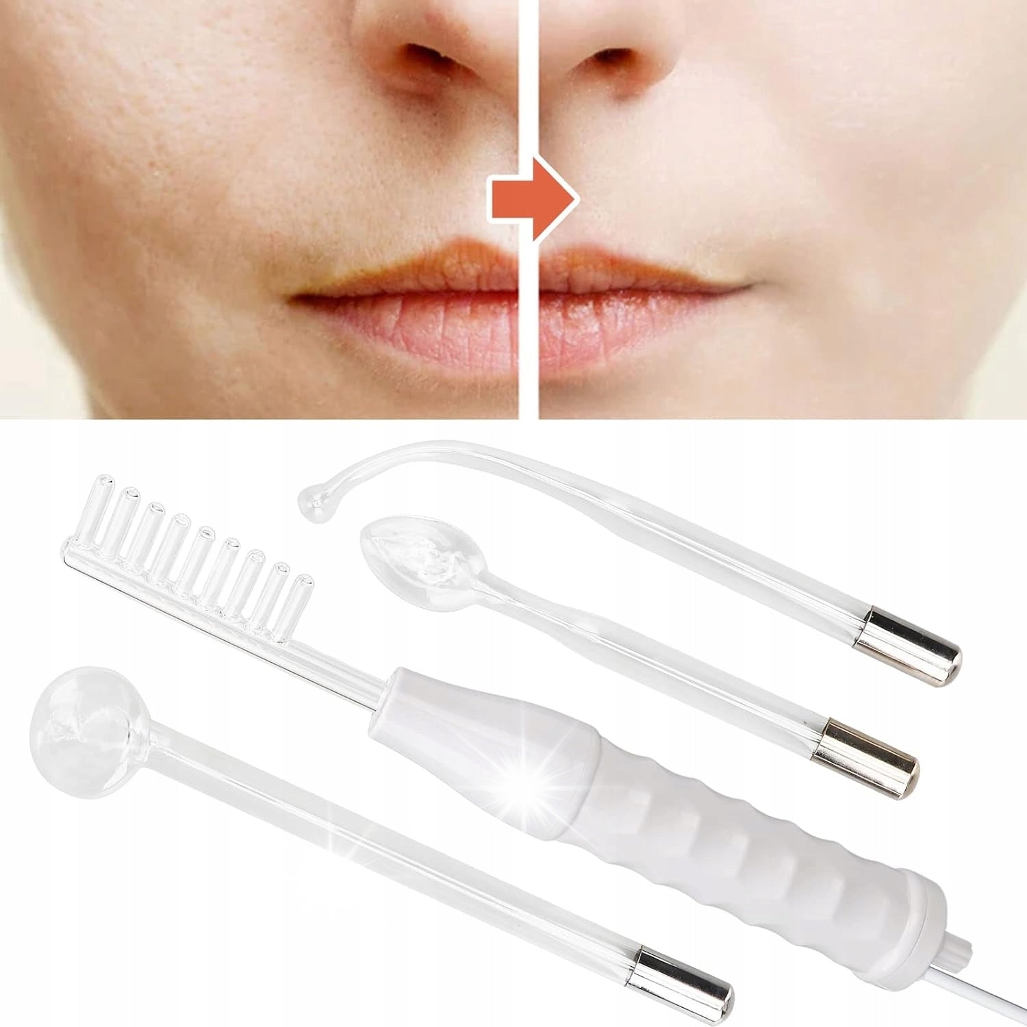 High Frequency Therapy Device Portable Acne Treatment