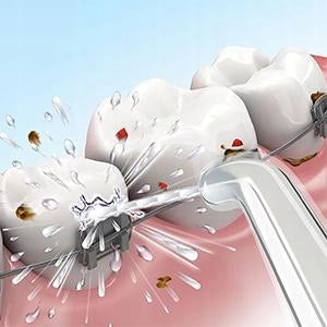 IRRIGATOR FOR CLEANING IMPLANT TEETH 8 TIPS Manufacturer code 0JJV44G