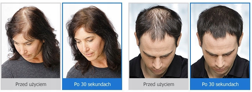 Pulverförmige Fasern Nanogen Keratin 15 g, weiß, für einen Haareffekt 