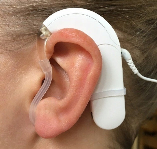 Miclock - holder / ear mount for speech processor Manufacturer code EHmiclock