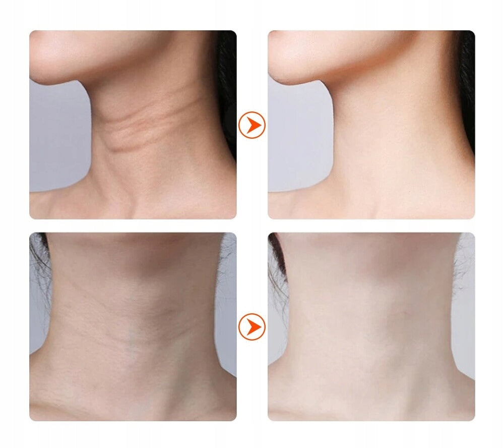 NECK AND FACE FIRMING MASSAGER MESOTHERAPY LED VIBRATION WARM CURRENT RF ! Manufacturer code mdsv3551