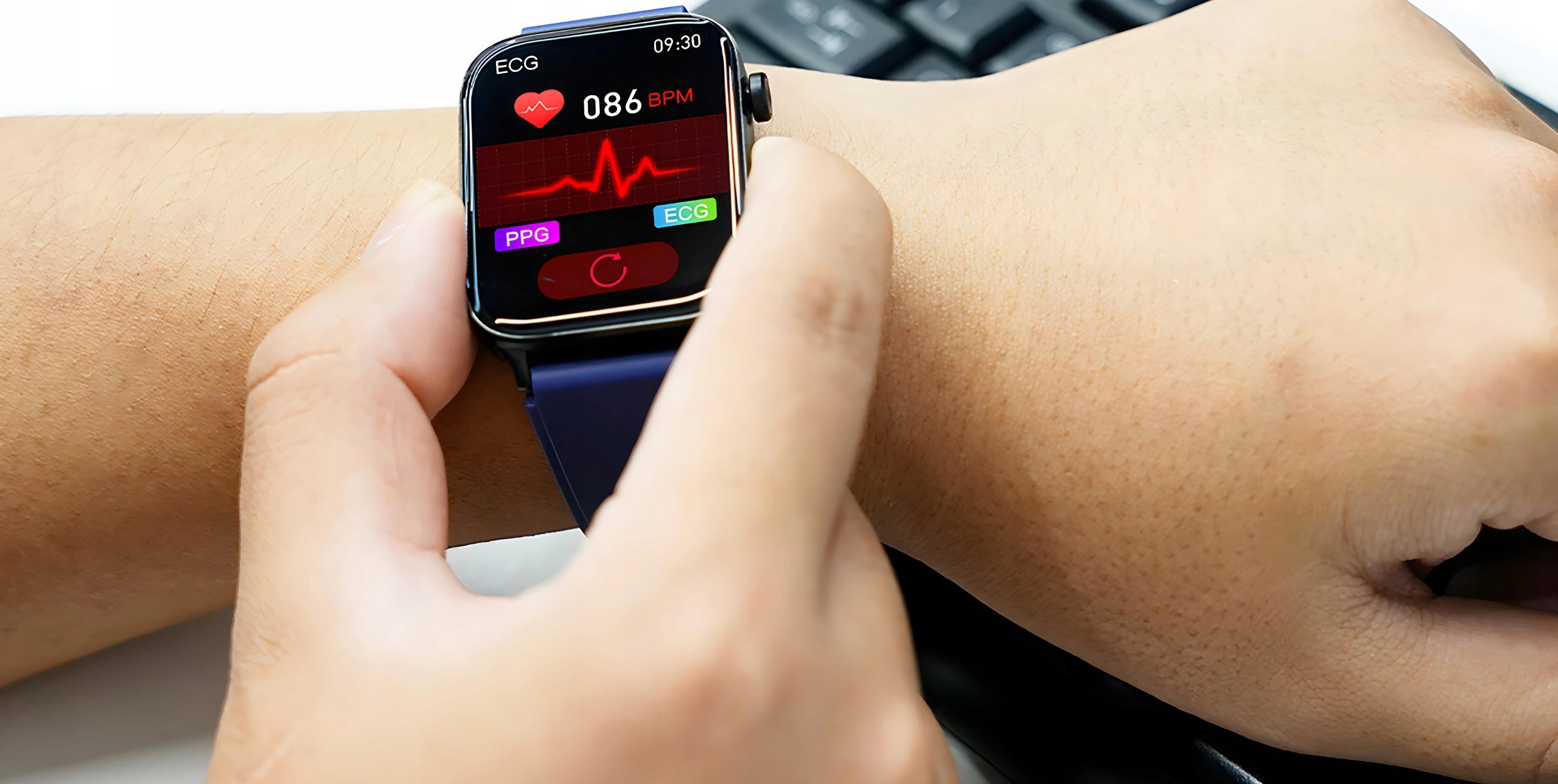 SMARTWATCH ECG watch Glucose Blood Pressure Monitor Talk AMOLED 3 stripes MENUPL Brand Bartomtime