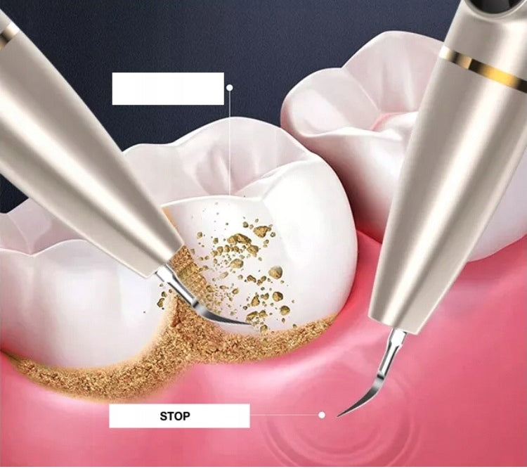 ULTRASONIC SCALER FOR REMOVING SCALE FROM TEETH safe and modern EAN (GTIN) 5906353221312