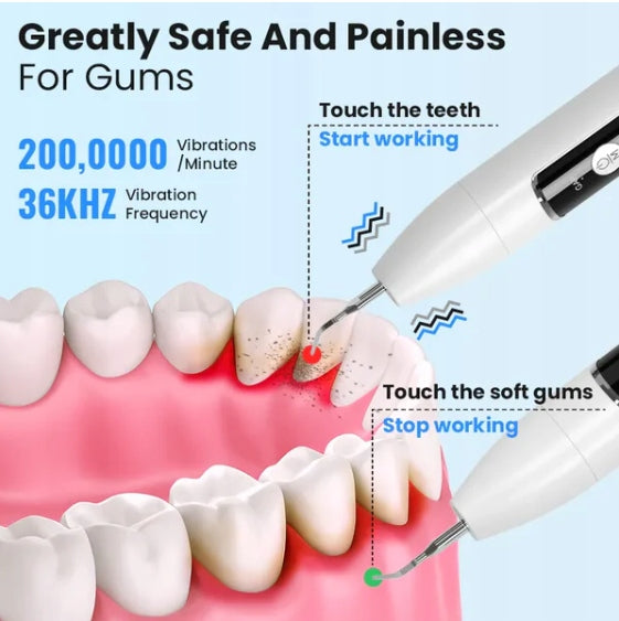ULTRASONIC TARTAR TEETH CLEANING KIT J10 Manufacturer code J10
