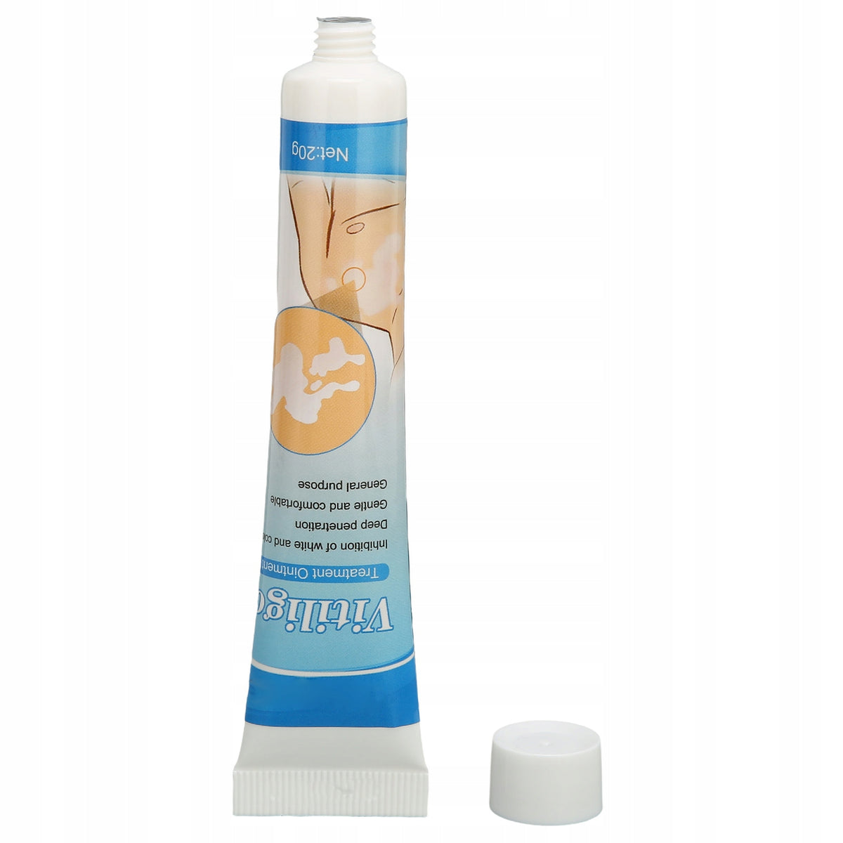 VITILIGO TREATMENT OINTMENT FOR SKIN PIGMENTATION 20G VITILIGO CREAM Manufacturer code 20103111
