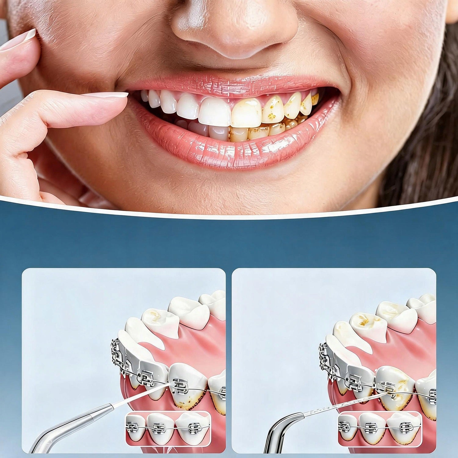 WIRELESS DENTAL IRRIGATOR STRONG PROFESSIONAL 4 NOZZLES Packaging status original