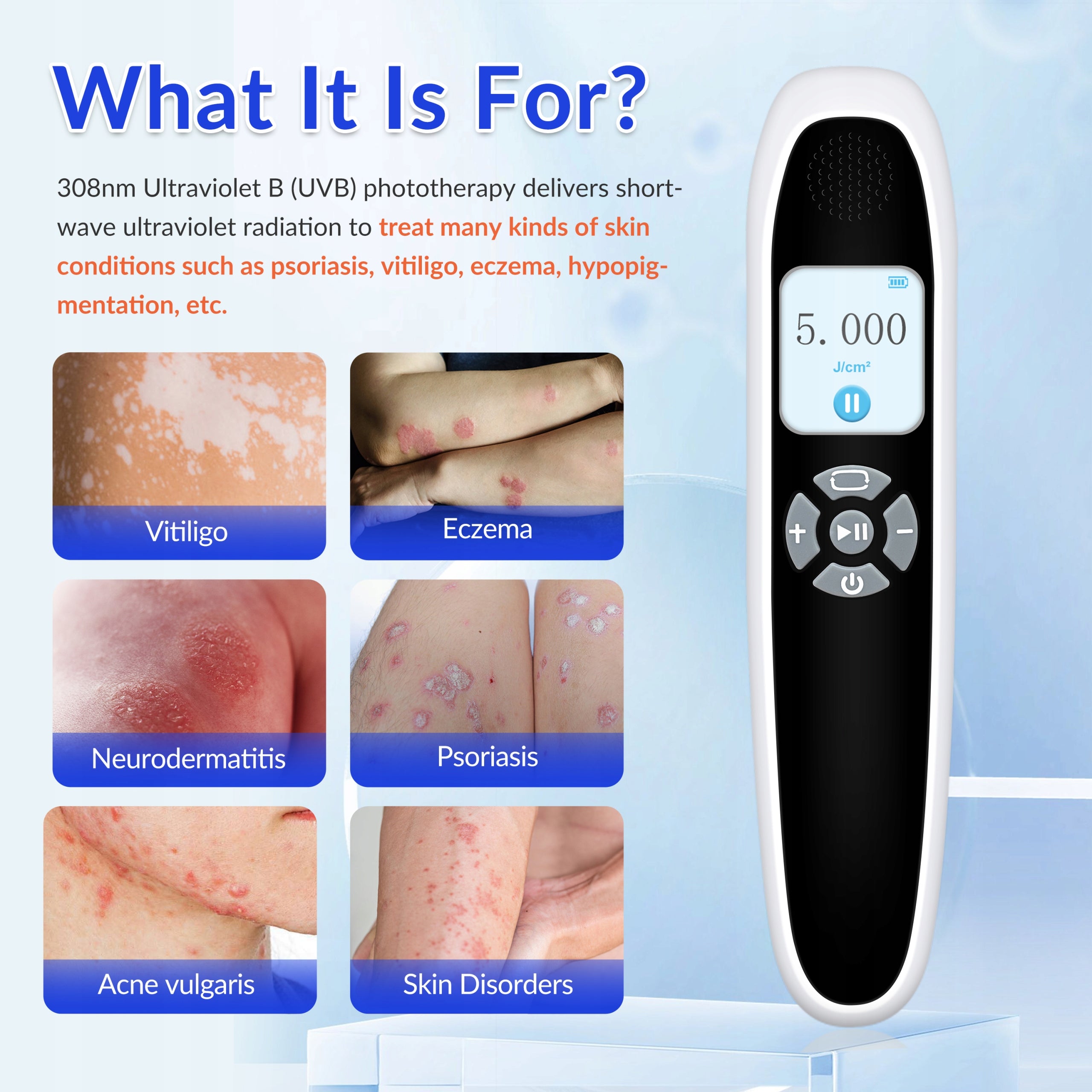 ZJZK Uvb Phototherapy Light 308nm for Psoriasis inflammatory skin diseases Packaging status original