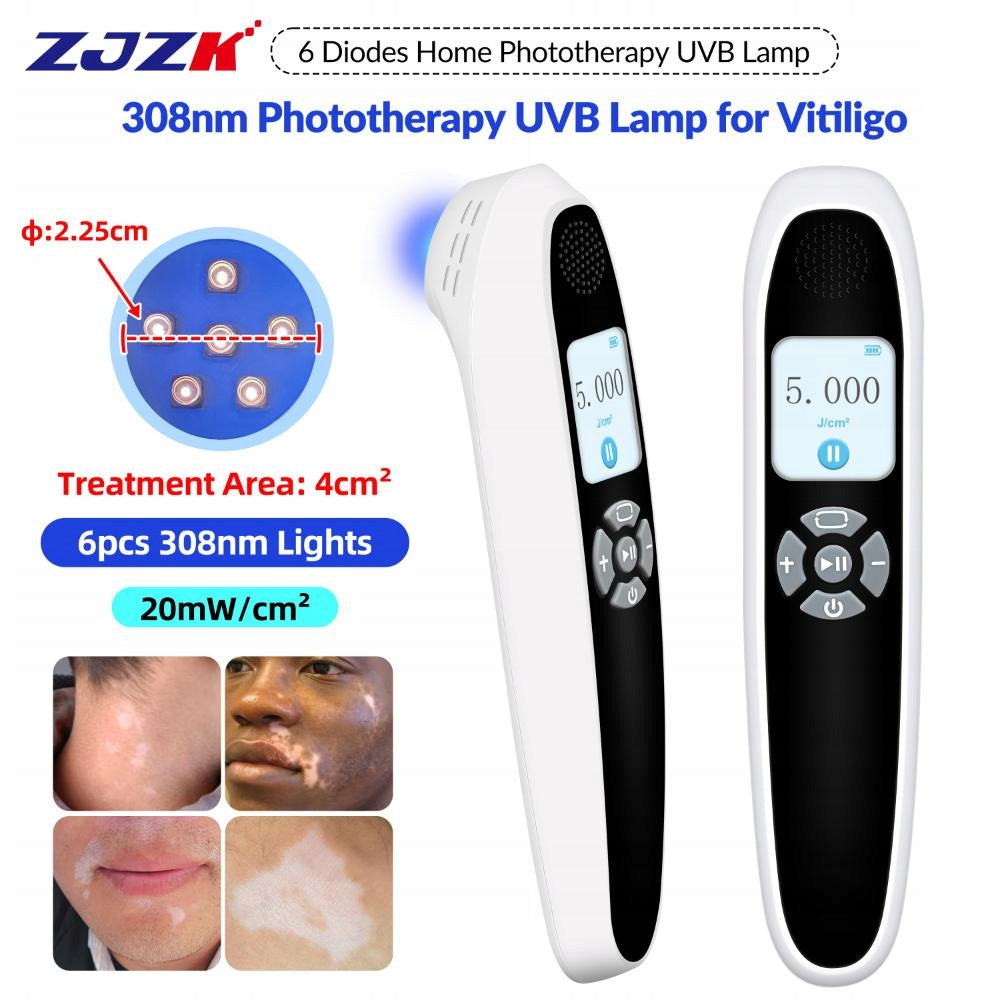 ZJZK Uvb Phototherapy Light 308nm for Psoriasis inflammatory skin diseases